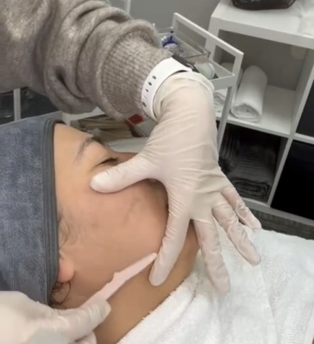 dermaplaning